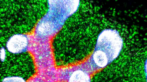Megumi Inoue Alain Chédotal Institut de la Vision A Human Cell Atlas image of the developing lung, illuminated in orange, purple and green