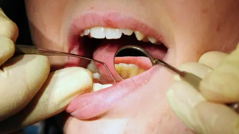 PA A close-up image of a person's teeth being worked on by a dentist. The patient's mouth is open and two hands, in latex gloves, hold a dental mirror and a dental pick.