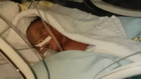 MADDY HOPSON MADDY AS A BABY IN HOSPITAL