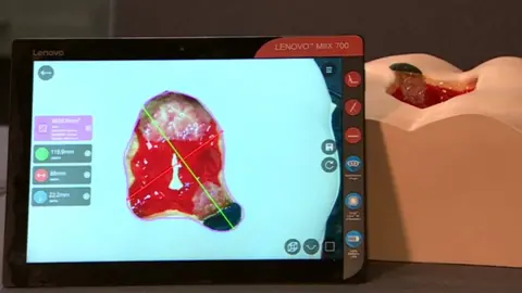 BBC 3D model of wound