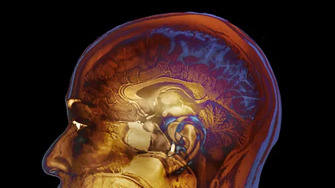 SPL Can you measure a brain by counting neurons? Not really (Credit: SPL)