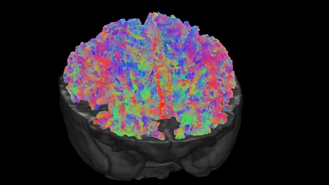 dHCP The scanners can record 10 million tracts in the newborn brain, which together form the building blocks for the baby's budding skills (Credit: dHCP)