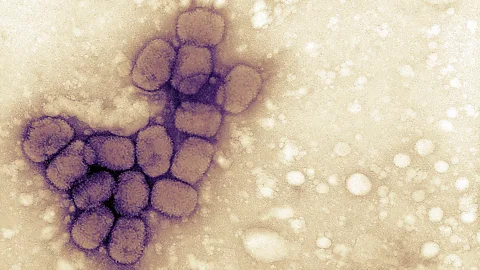 Getty Images Before Jenner's involvement, the treatments for smallpox ranged from the useless to the bizarre (Credit: Getty Images)