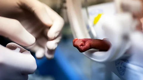 Conrad Bornman/Getty Images Incubators can save lives by helping to keep underweight premature babies stable but are not available in all parts of the world (Credit: Conrad Bornman/Getty Images)