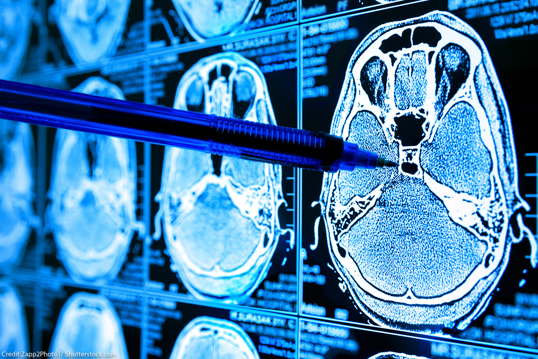 Algorithms Are Making Decisions About Health Care, Which May Only Worsen Medical Racism Algorithms Are Making Decisions About Health Care, Which May Only Worsen Medical Racism