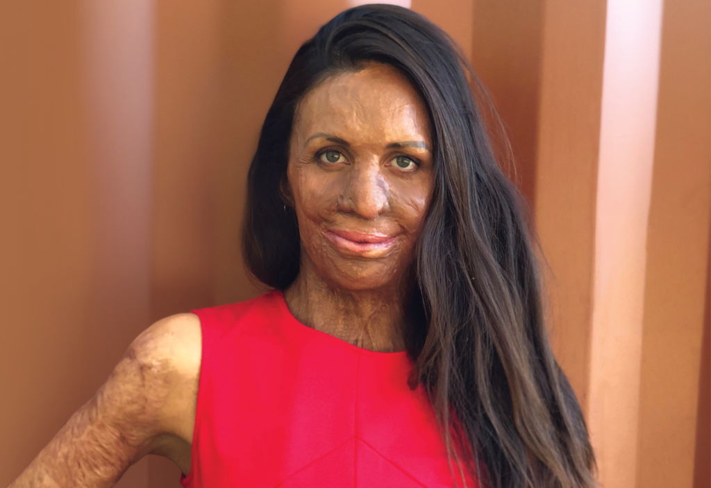 Turia Pitt on the engineering mindset that helped her get through tough times Turia Pitt on the engineering mindset that helped her get through tough times
