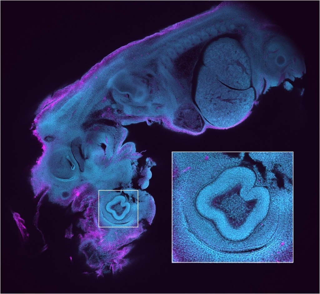 Let Us Now Praise the Invention of the Microscope