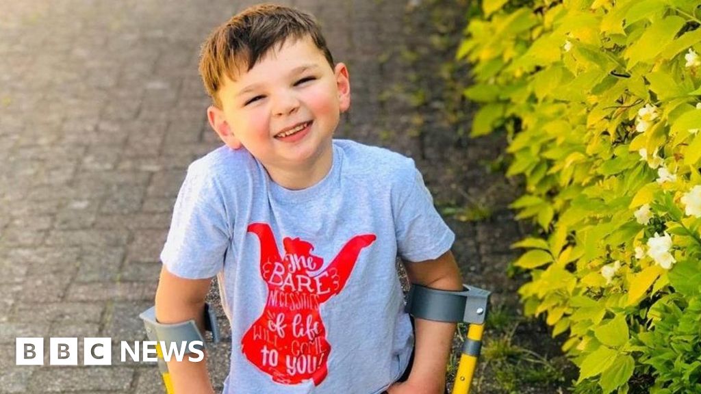 Tony Hudgell, 5, completes 10km walk on prosthetic legs Tony Hudgell, 5, completes 10km walk on prosthetic legs