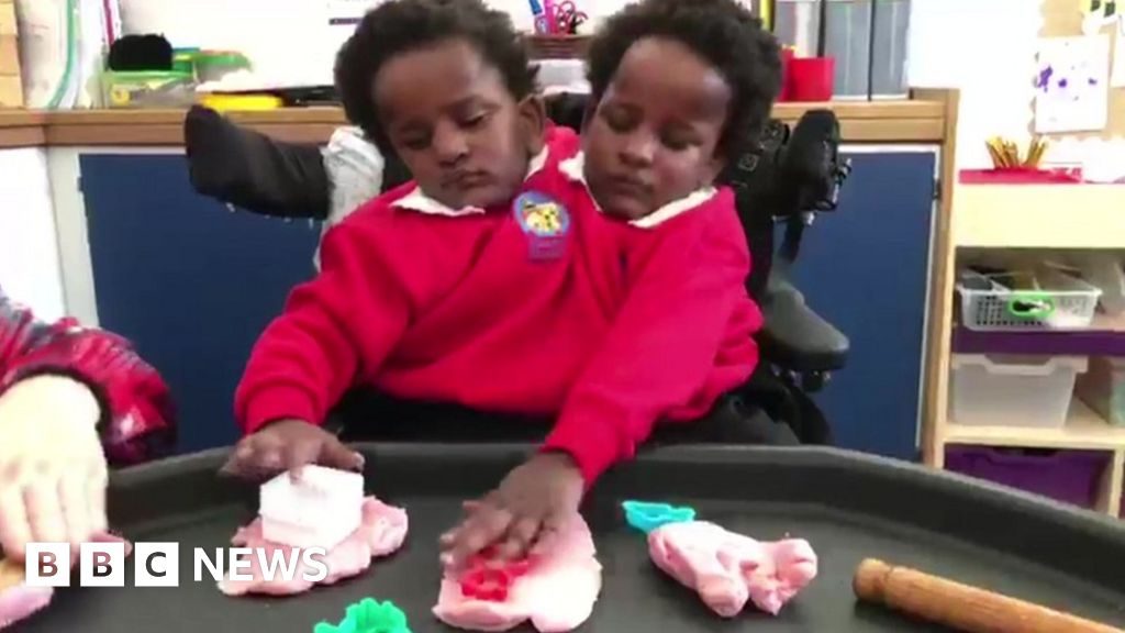 Conjoined twins Marieme and Ndeye settling at Cardiff school Conjoined twins Marieme and Ndeye settling at Cardiff school