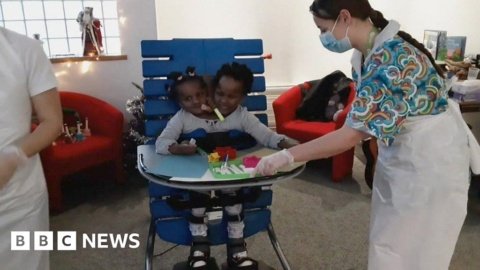 Conjoined twins ‘learning to stand’ for Cardiff school