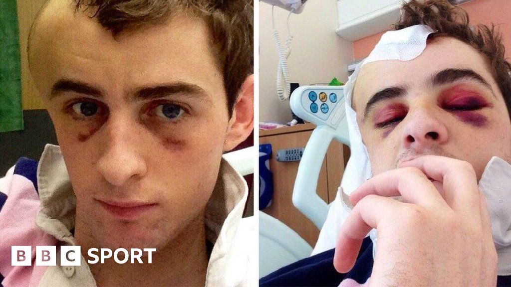 Brian Toomey: Jockey has ‘achieved impossible’ Brian Toomey: Jockey has ‘achieved impossible’