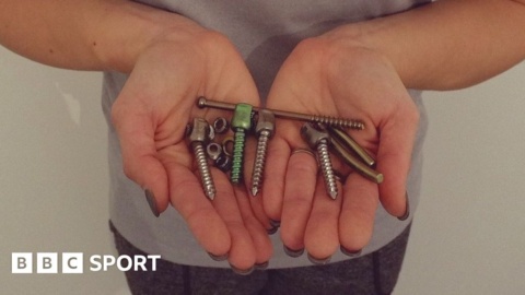 Vicky Barnes: British sprint cyclist on her recovery from horrific crash