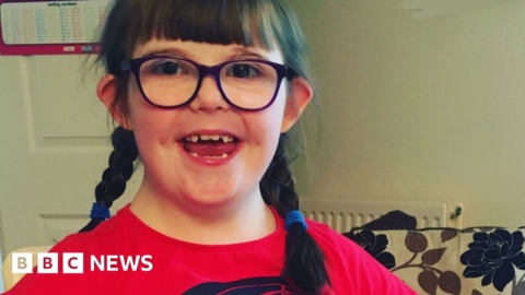 Cardiff University Down’s syndrome vision research prize