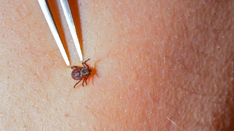 Lyme disease is becoming more common. But its symptoms aren’t always easy to spot