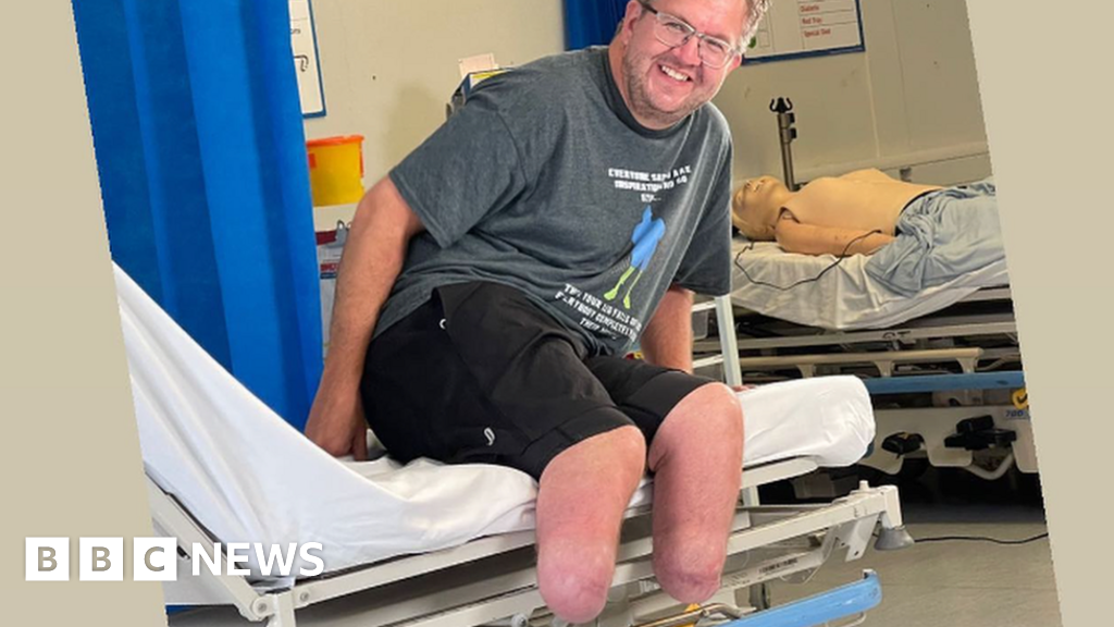 What losing his legs taught surgeon about life What losing his legs taught surgeon about life
