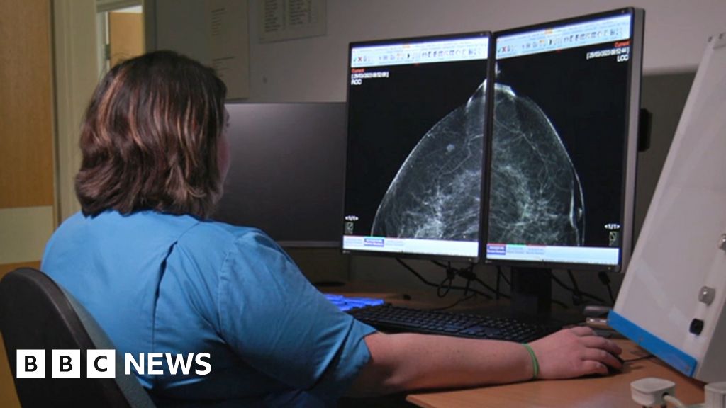 Aberdeen AI trial helps doctors spot breast cancers Aberdeen AI trial helps doctors spot breast cancers
