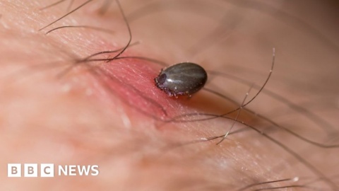 Tick saliva ‘gold mine’ blocks killer heart condition