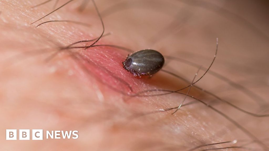 Tick saliva ‘gold mine’ blocks killer heart condition Tick saliva ‘gold mine’ blocks killer heart condition