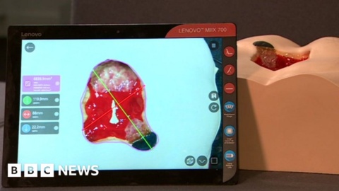 Welsh firms’ hi-tech bid to to help cut cost of bedsores