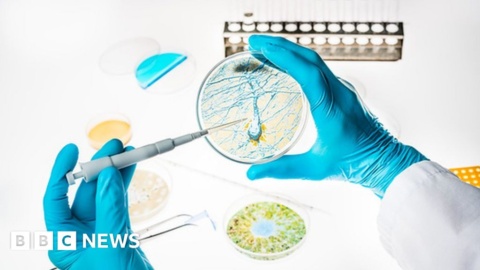 Pharma giant Pfizer pulls out of research into Alzheimer’s