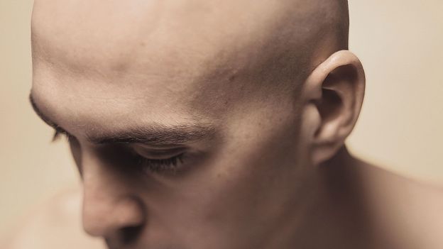 One doctor’s gruesome way to banish baldness One doctor’s gruesome way to banish baldness