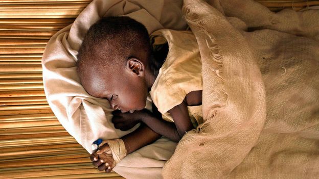The mystery of East Africa’s ‘nodding disease’